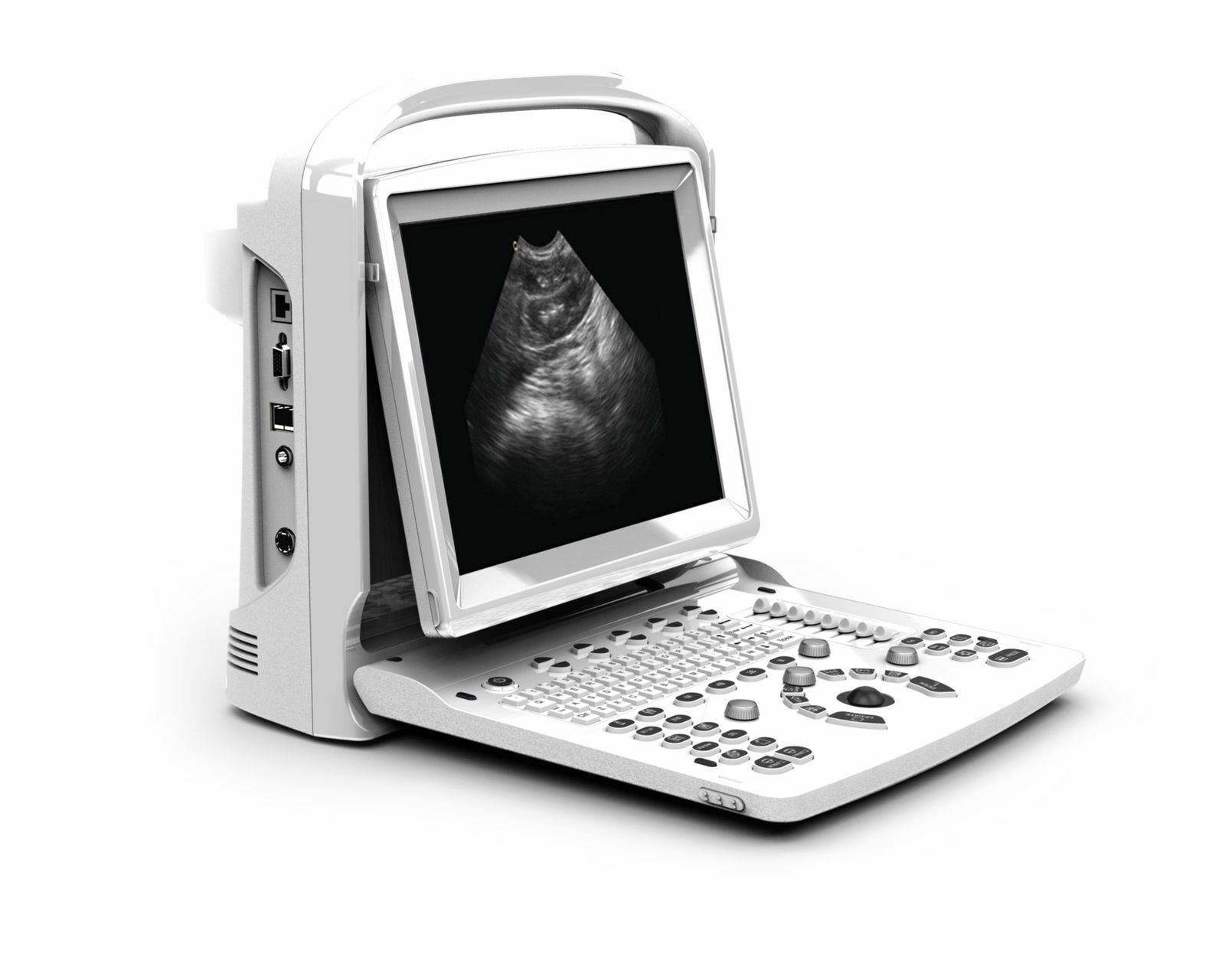 Chison ECO3 Vet Veterinary Ultrasound With Equine Rectal Probe Warranty 3 Years