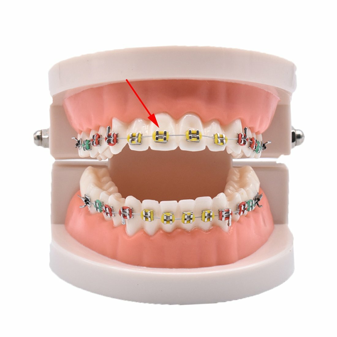 2080 Black Dental Ligature Ties, Rubber Bands, Braces Teeth Brackets, 2 Bags