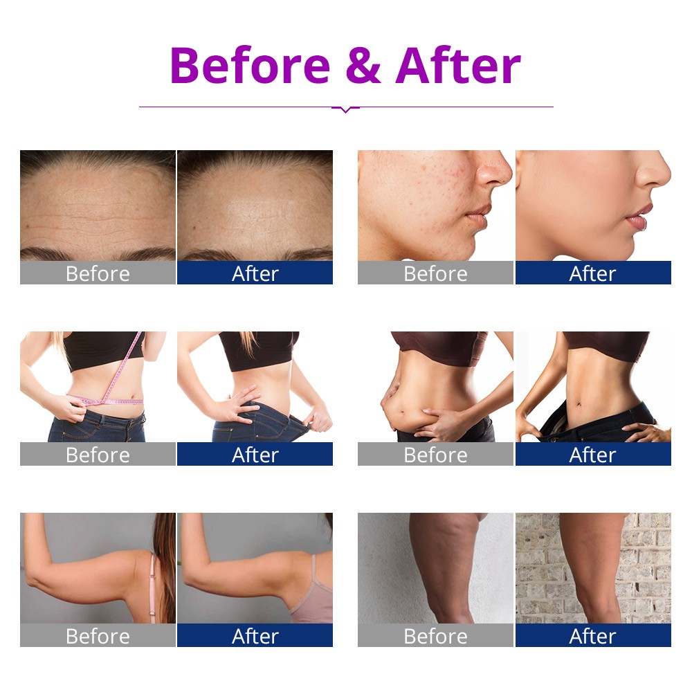 Elite 6 Attachments Beauty Machine for Boost Skin Firmness & Enhance Body Line
