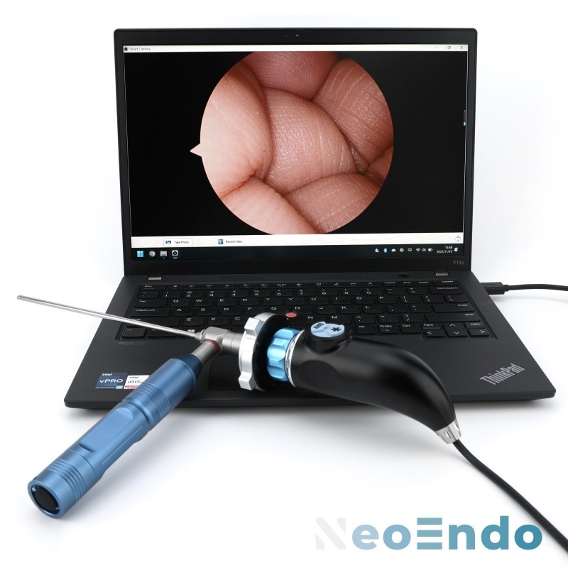 Portable Medical USB Endoscope Camera 1080P Full HD For ENT Inspection